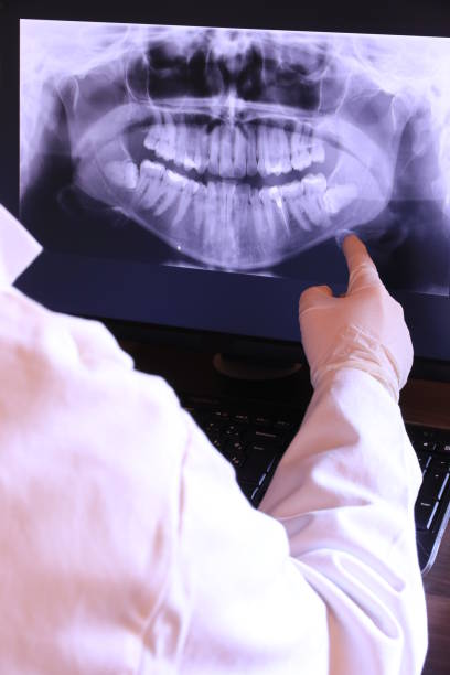Best Emergency Dentist for Knocked-Out Tooth in Northbrook, IL