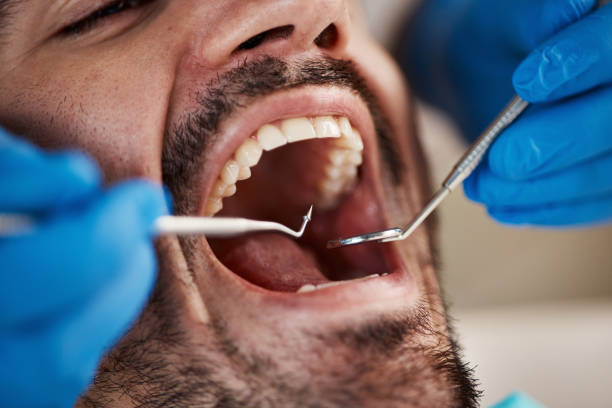 Best Broken or Cracked Tooth Emergency Dentist in Northbrook, IL